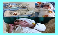 افتتاح بخش پست NICU